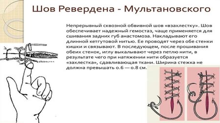 slide-1.jpg
